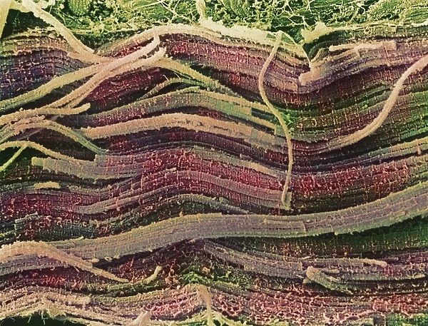 Coloured SEM of skeletal (striated) muscle fibres