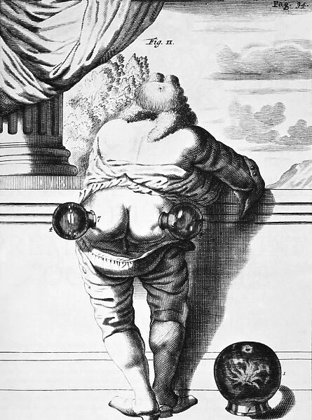 Cupping, historical artwork