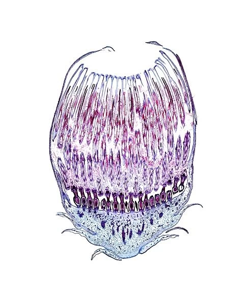 Dandelion flower head, light micrograph