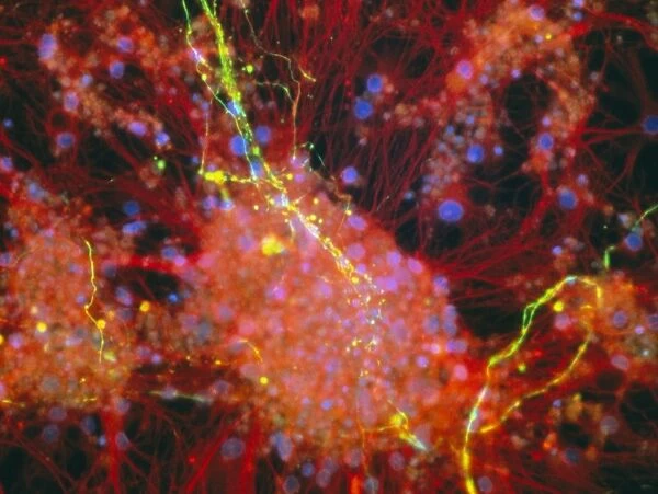 Immunofluorescent LM of rat brain cells and axons