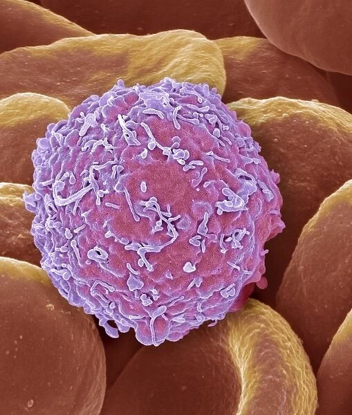 Leukaemia cell, SEM