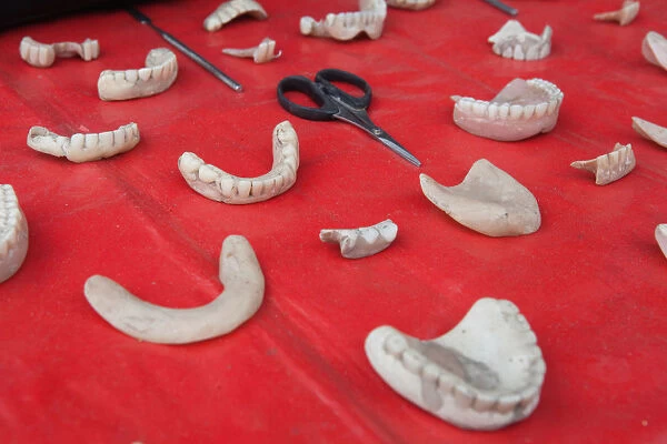 India, West Bengal, Asansol, Display of dentures and dental equipment by a street dentist