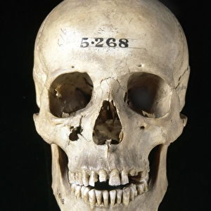 Homo sapiens skull (Italy)