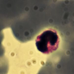 Light Micrograph: Plasmodium: a parasitic protozoa in blood; Magnification x 7, 500 (if print A4 size: 29. 7 cm wide)
