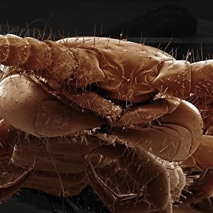 Scanning Electron Micrograph (SEM): Common Centipede - Magnification x 50 (A4 size: 29. 7 cm width)