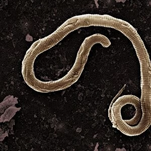 Scanning Electron Micrograph (SEM): Micro-filarial worm; Magnification x 4500 (A4 size: 29. 7 cm width)