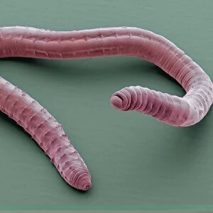 Annelid worm, SEM C014 / 1428