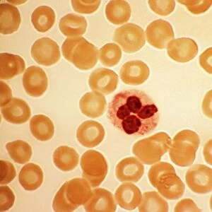 Dohle bodies in blood cell, micrograph