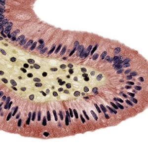Gall bladder surface, light micrograph