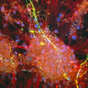 Immunofluorescent LM of rat brain cells and axons