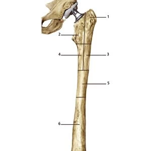 Paprosky femur defect classification C016 / 6621