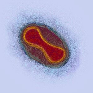 Smallpox virus particle, TEM