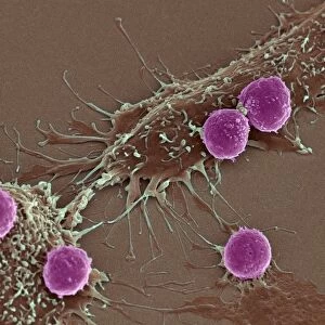 T lymphocytes and cancer cells, SEM