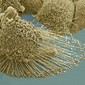 Scanning electron micrograph of an apoptotic HeLa cell